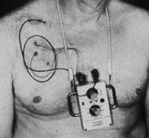Pacemaker 1958