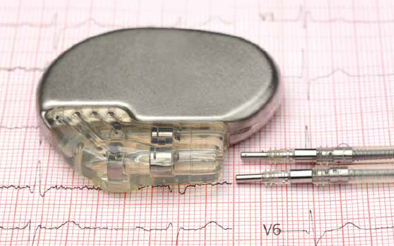 Pacemaker